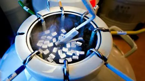 Getty Images Hand retracting frozen sperm specimen used in invitro fertilization. - stock photo