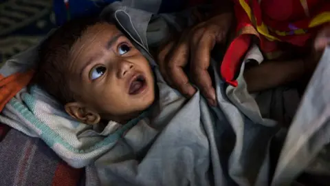 Getty Images A malnourished child awaits treatment at a clinic in the Fakir Bagan slum area of Kolkata. The clinic is run by the charity Calcutta Kids. Founded in 2004, Calcutta Kids is a not-for-profit public health organization committed to the health and empowerment of the underserved women and young children in the Kolkata slum area of Fakir Bagan