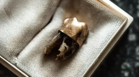 Jelle Vermeersch The gold tooth of Patrice Lumumba in a padded box photographed in Belgium in 2016