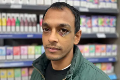 Amit Puntambekar faces the camera, wearing a green quilted jacket, in front of a store display of vapes. He has a plaster under his left eye where he was punched. 