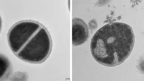 Weizmann Institute of Science Two side by side pictures of bacteria under a microscope, one is healthy and one is rupturing and leaking it's contents.